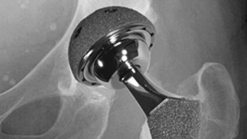Medical Device